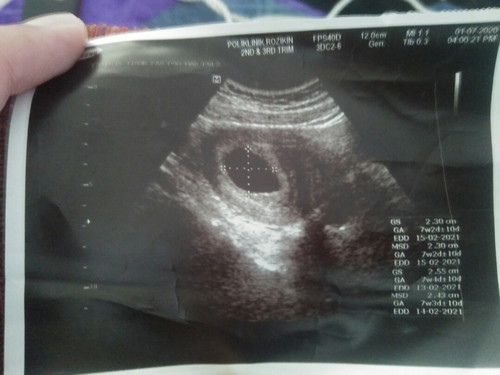 Scan 7w nampak kantung je