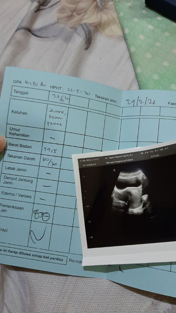 Penyebab kantong kehamilan belum terlihat ?