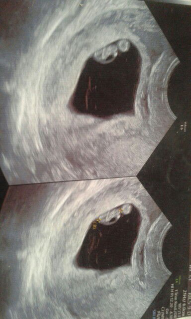 Sitti Fitroh profile icon