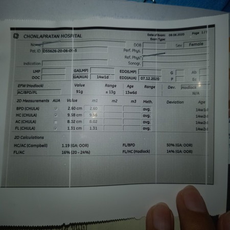 อยากรุ้ว่าน้ำหนักลูกตามเกณฑ์ใม14สัปดาห์คะ