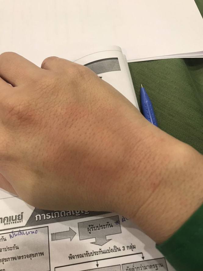 ผลข้างเคียงจากการผ่าตัด