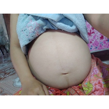 ท้องโตมากค่ะ