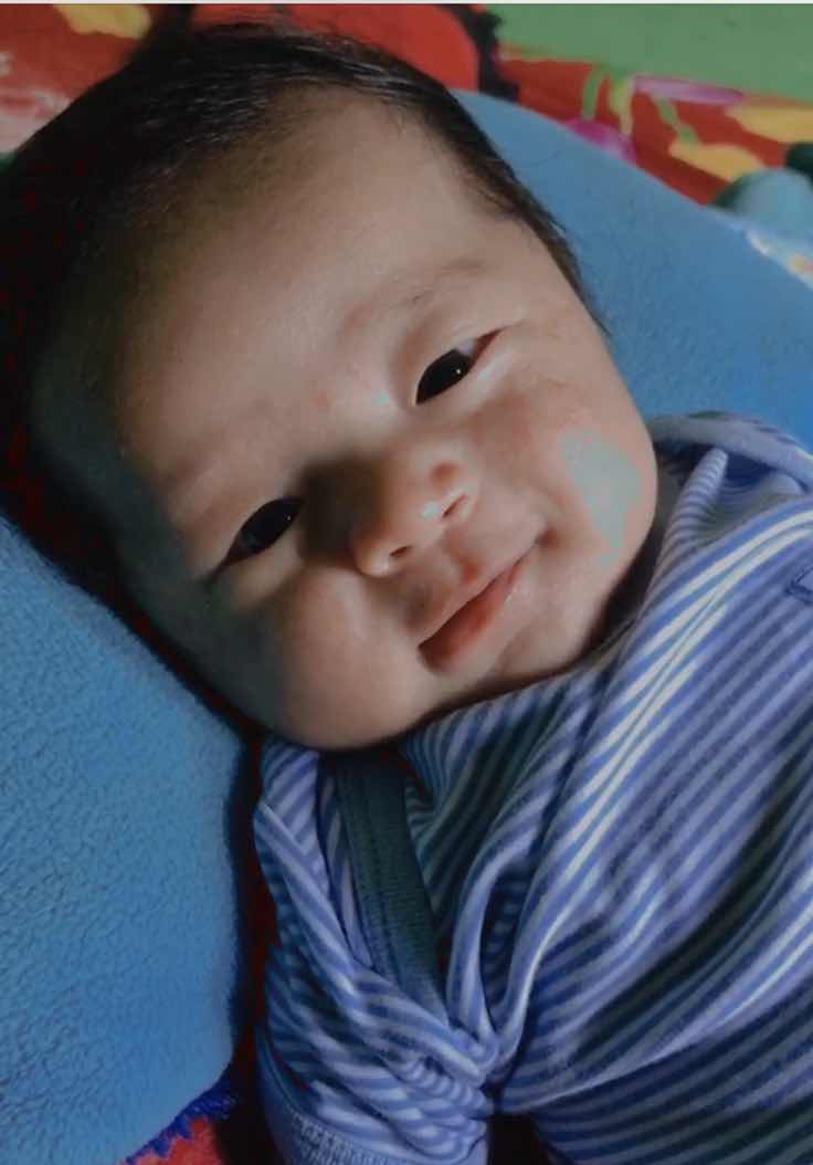 Merah merah di wajah