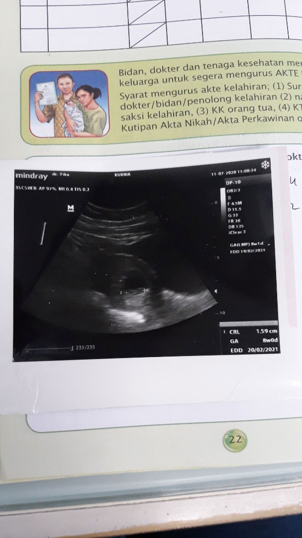 kurnia ramadhani putri profile icon