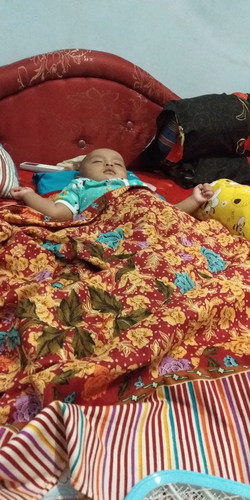 perut kembung pada bayi