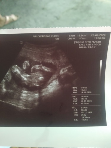 สอบถามแม่ๆๆค่ะตั้งมาหลายอันแล้วไม่มีใครช่วยตอบเลย