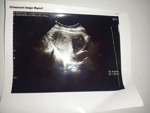 janin tidak berkembang.