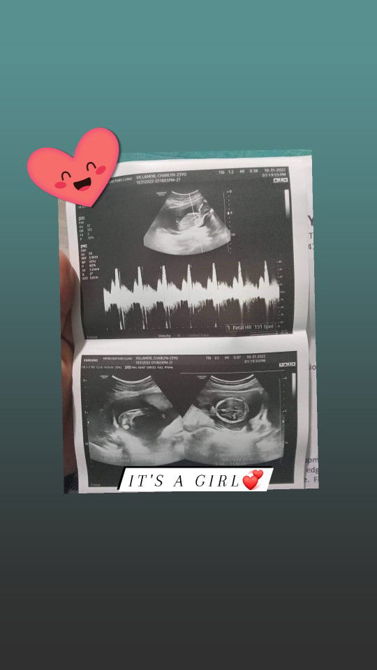 Charlyn Villamor Miranda profile icon