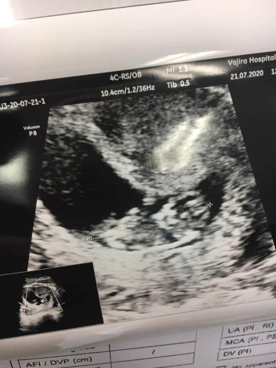 กั้ง' เย้ profile icon