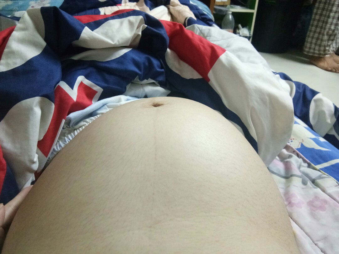 ตอนนี้ทเองได้35วีคแล้วจ้า เวลานอนชอบท้องเบี้ยว มีแม่ๆคนไหนเป็นบ้างคะ แล้วขนาดหน้าท้องเล็กไปไหม