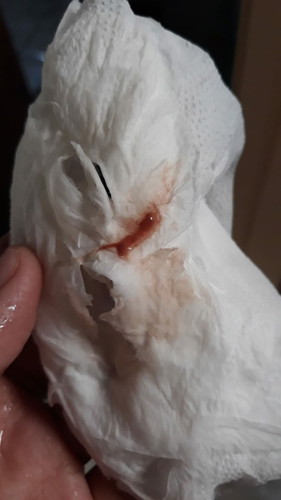 ให้นมบุตรขณะตั้งครรภ์ได้หรือไม่