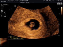 Duangkamon NatePloy profile icon