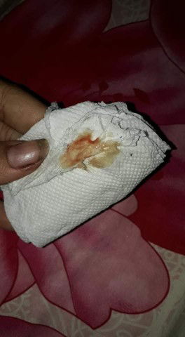 hơi tế nhị các mom thông cảm ạ