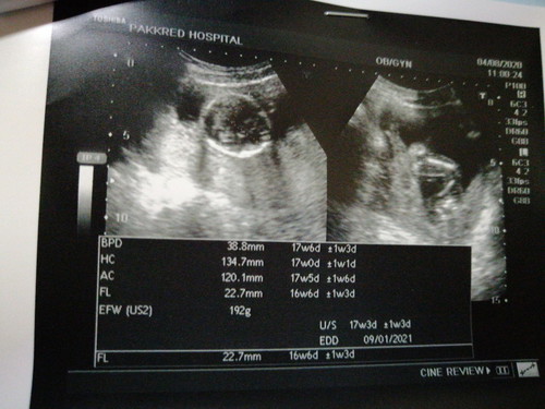 อ่านใบอัลตร้าซาวด์📍