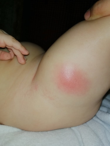 Penta-Hib 2 Vaccine