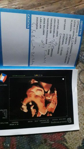 Riska Andryani profile icon