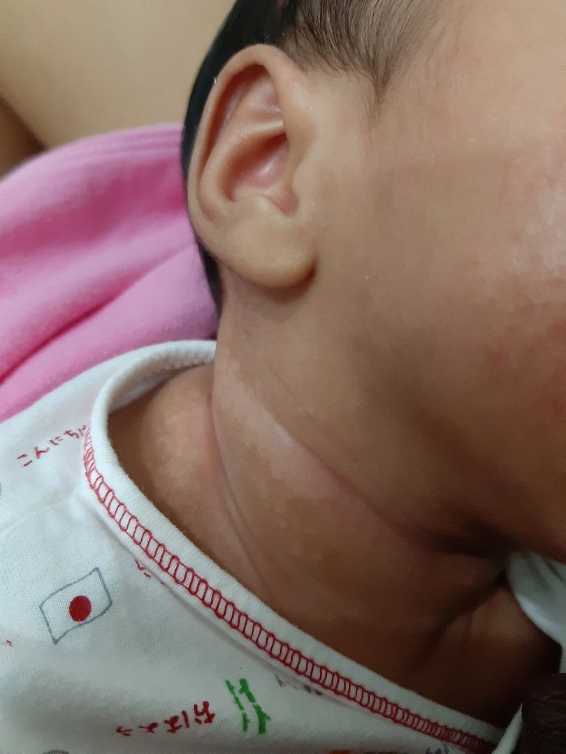 รอยด่างๆแบบนี้จะหายมั้ยคะ