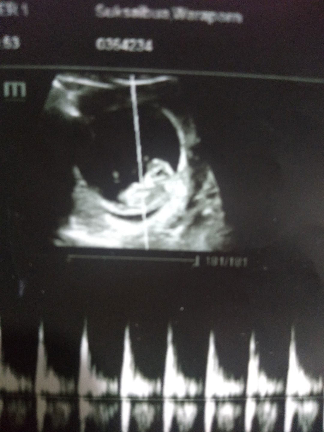 Waraporn Suksaybow profile icon