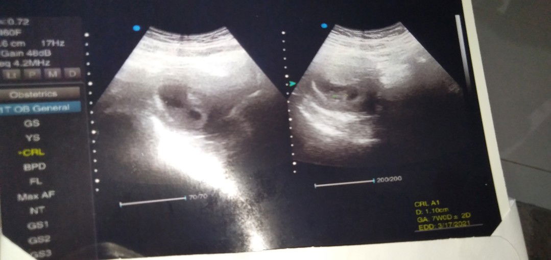 janinnya kurang besar