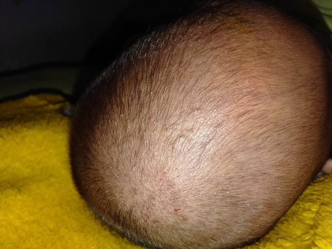 kulit bayi