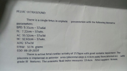 ultrasound