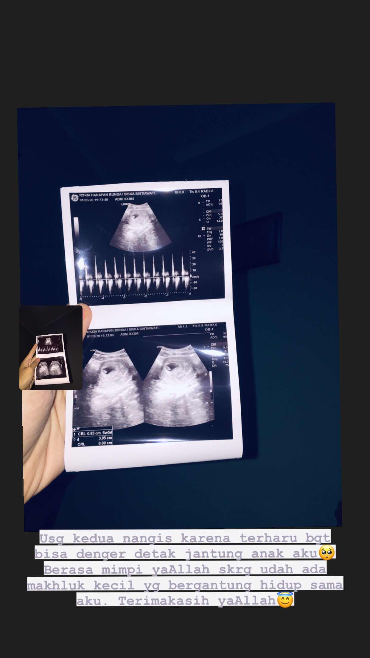 Siska Sintiawati profile icon