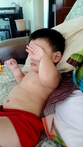 อยากสอบถามลูกไม่ยอมเปิดตามองพร้อมกัน2 ข้าง