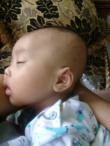 kepala bayi