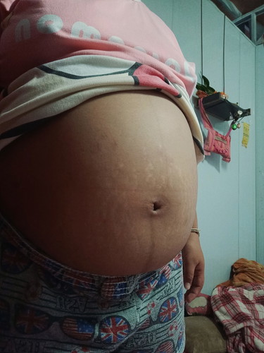 อยากรู้ว่าท้องแบบนี้ผู้หญิงรือผู้ชายคร้