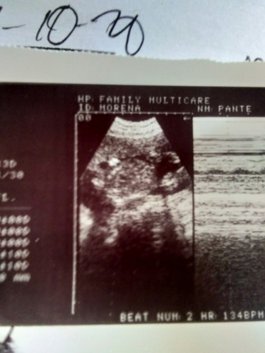 pabasa po ...if boy or girl..