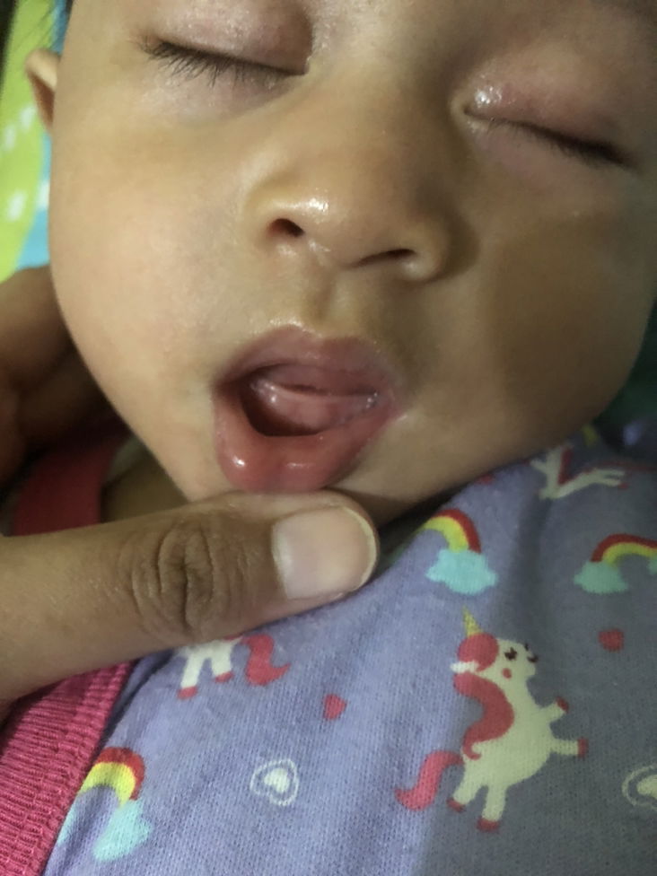 Apa ini tanda tumbuh gigi