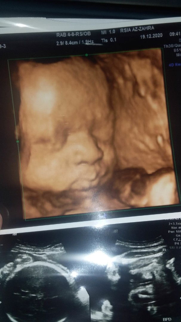 Siska Damayanti profile icon