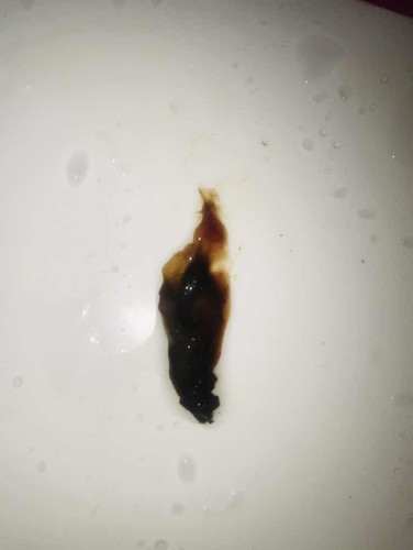 เลือดออกแต่เด็กไม่เป็นไร