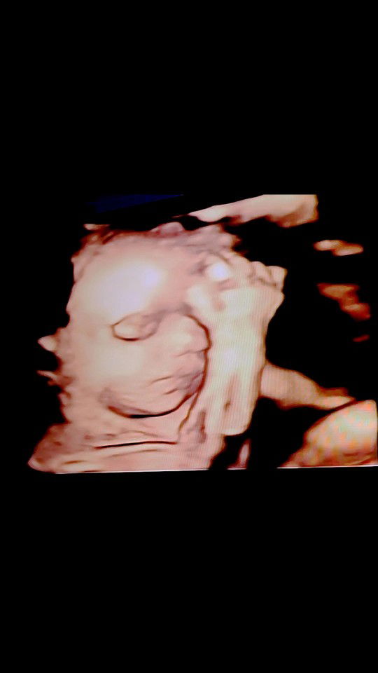 Fadilah Sutarma profile icon