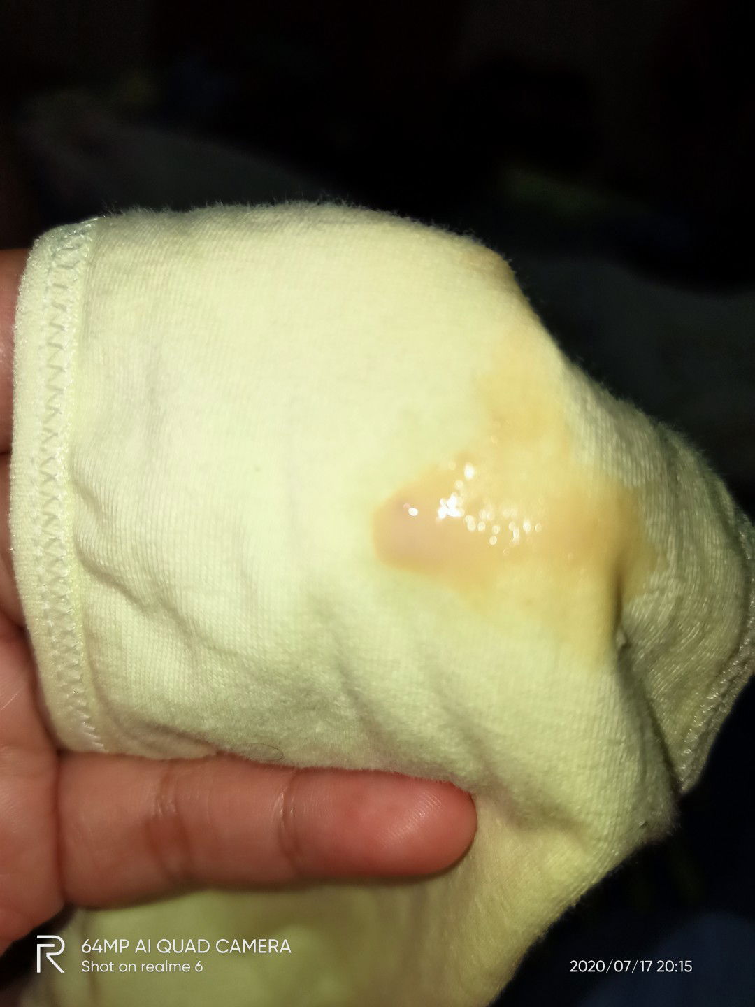 keputihan saat hamil