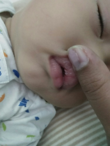 ในปากลูกเป็นแบบนี้เป็นเพราะอ่ะไร