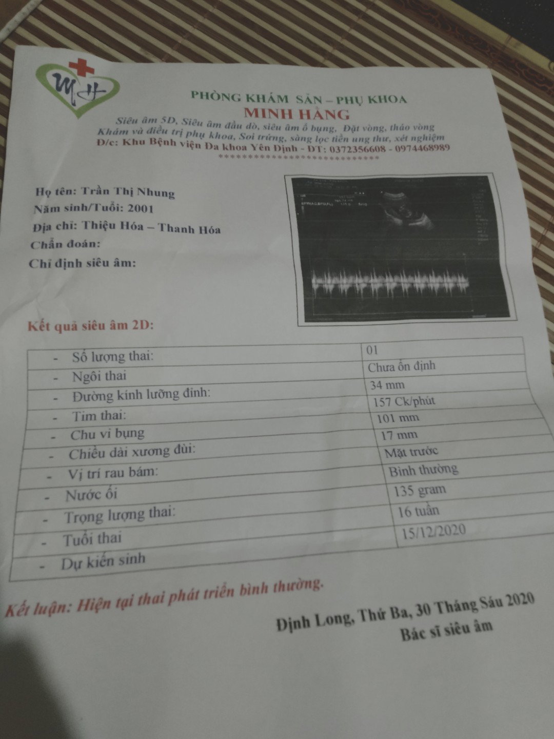 minh mang thai 16tuan bác sĩ bảo chim non mừng quá đi