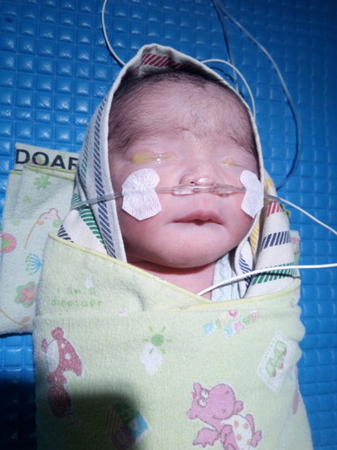 Mohon Doanya untuk kesembuhan my baby boy