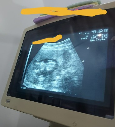 parang kunti po panubigan ko.