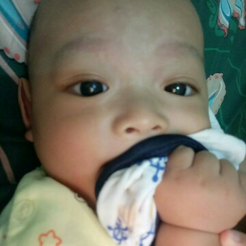 kulit mengelupas