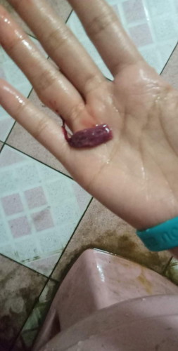 ตั้งครรภ์1เดือนแล้วมีเลือดไหลออกมา