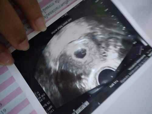 มีใครเคยไปซาวด์ครั้งแรกไม่เจอน้องบ้างคะ