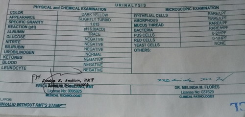 urinalysis