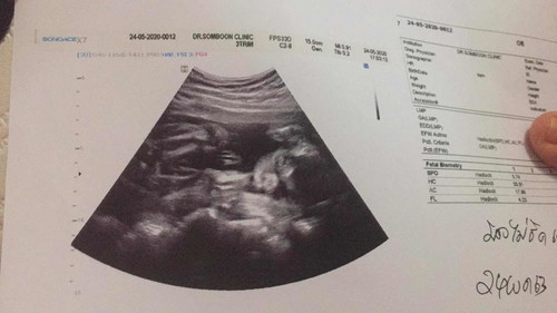 ขอความคิดเห็นจากแม่ๆหน่อยค่ะ🙏🏻🥰