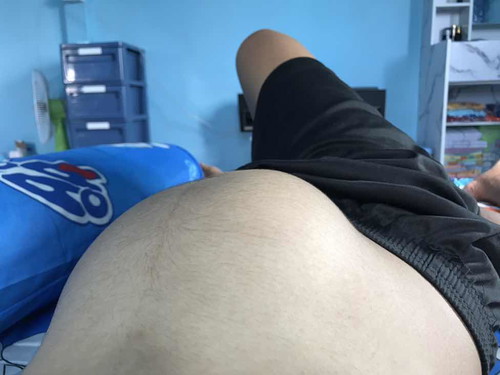 ลูกตัวโก่ง