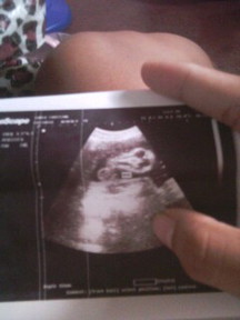 ultrasound