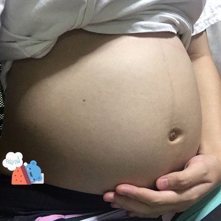 สอบถามประสบการณ์แม่ๆ