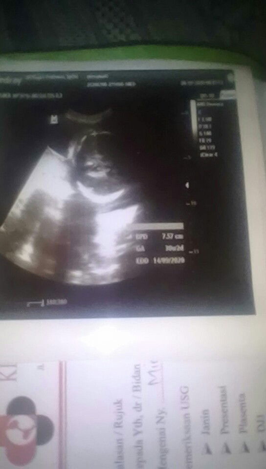 mirna wati profile icon