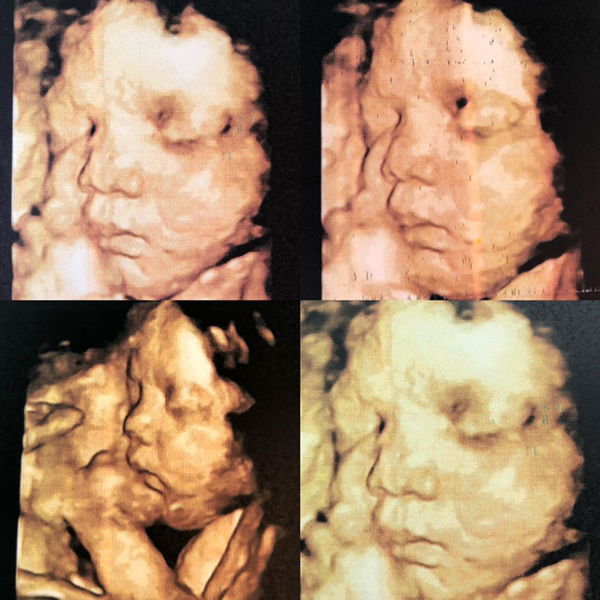 Baiyok Glom Nid profile icon