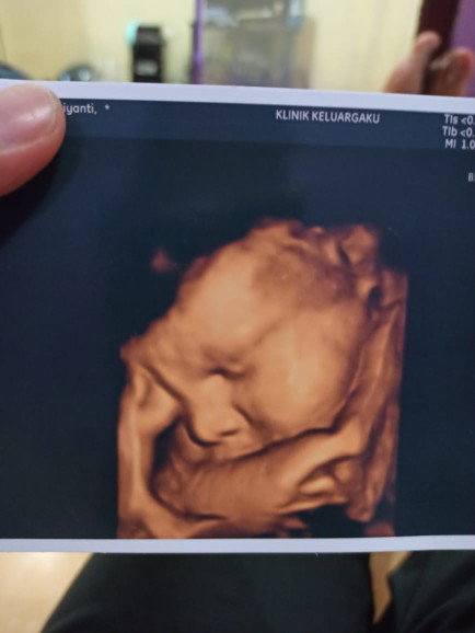 Novi Sri Yanti profile icon